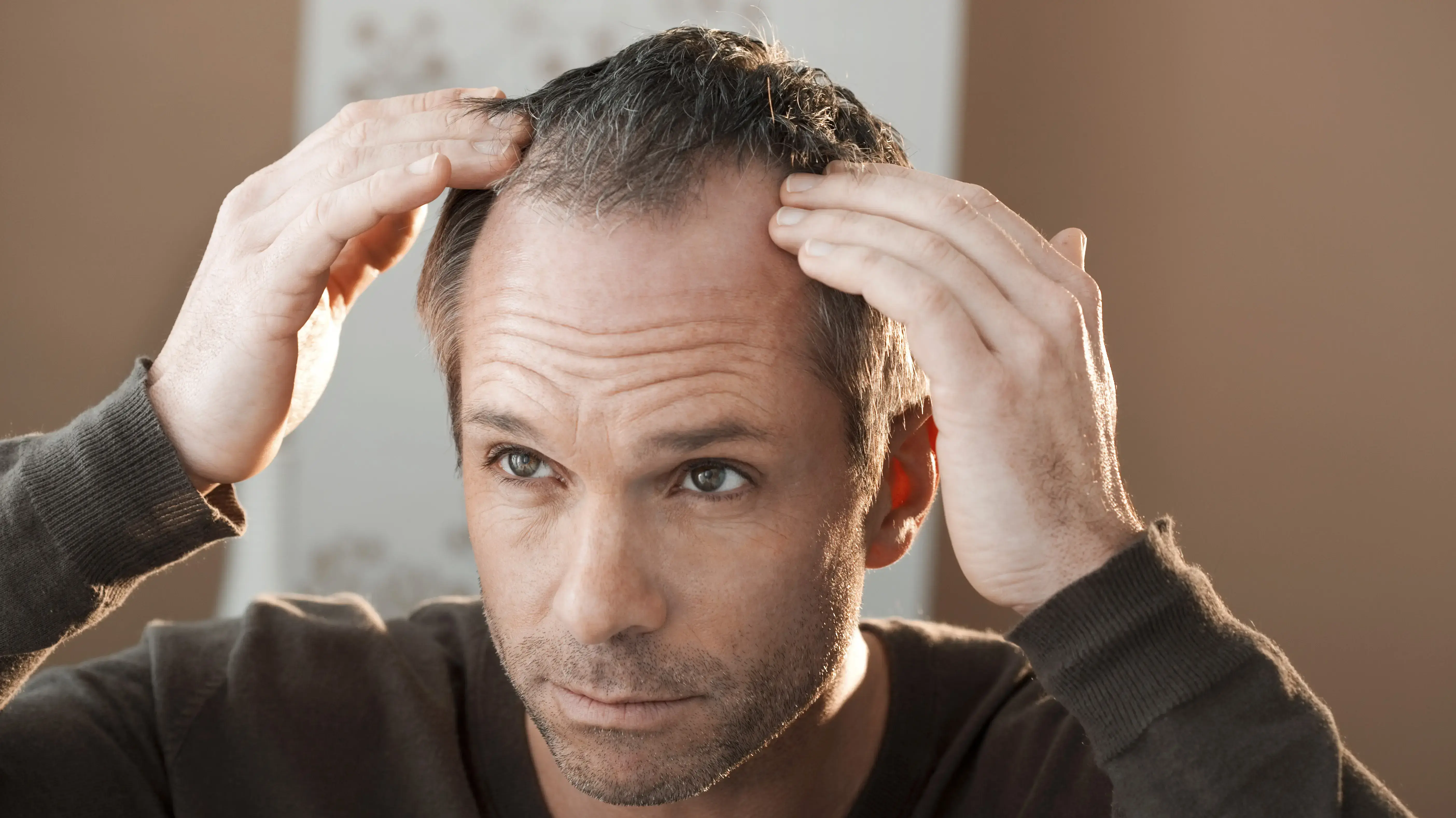 התקרחות או נשירת שיער? התקרחות או נשירת שיער?