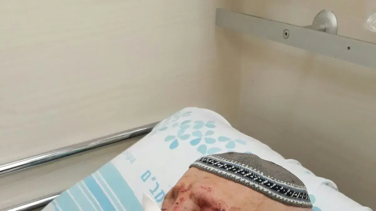 הפנסיונר אלכסנדר נדלסון שהותקף בחיפה בבית החולים הפנסיונר אלכסנדר נדלסון שהותקף בחיפה בבית החולים