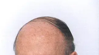 דוויד קליין דוויד קליין