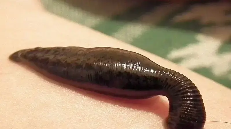 עלוקה עלוקה