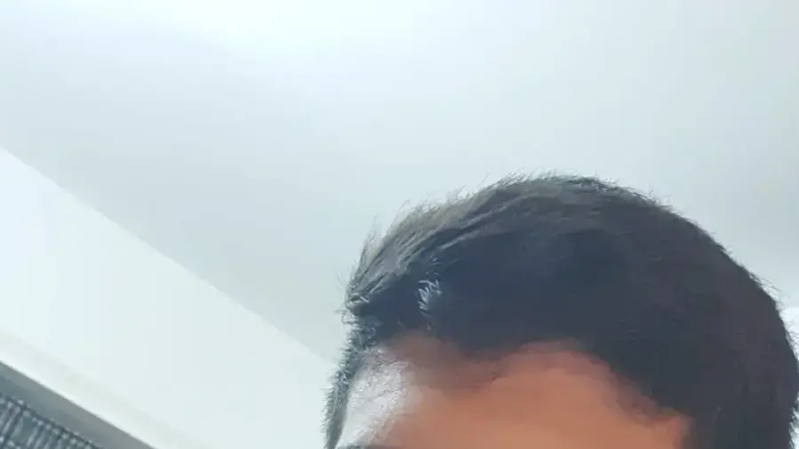 ישי שטרית שהותקף בטבריה וארבע שיניים נעקרו מפיו ישי שטרית שהותקף בטבריה וארבע שיניים נעקרו מפיו