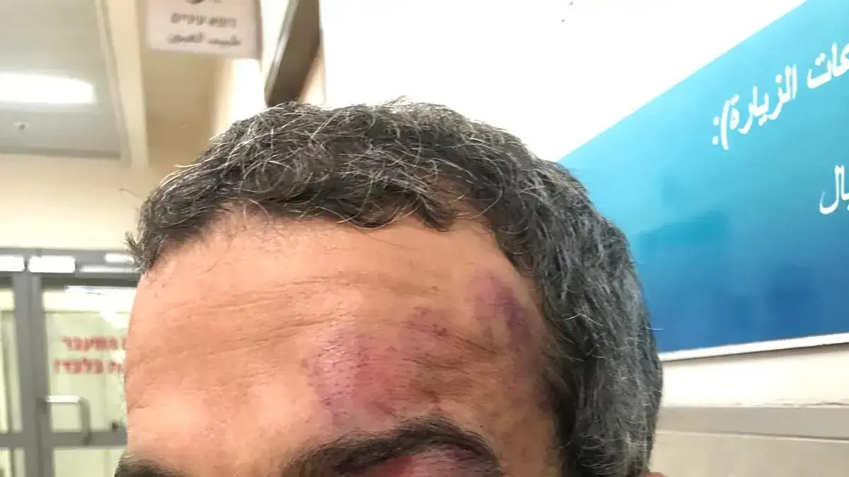 ניק פנקס ממושב ברמת הגולן שטוען כי הרביצו לו לאחר שהעיר למתארחים בצימר לא לקטוף מהמטע שלו, ספטמבר 2019 ניק פנקס ממושב ברמת הגולן שטוען כי הרביצו לו לאחר שהעיר למתארחים בצימר לא לקטוף מהמטע שלו, ספטמבר 2019