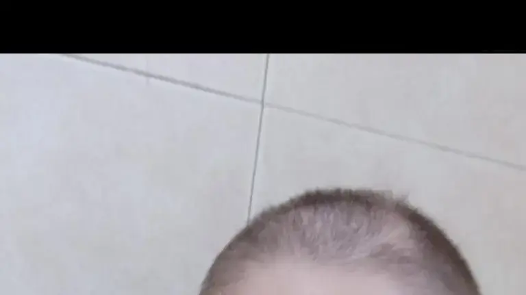 כמו שלט חוצות למילה סרטן. אלינור ילוז אחרי שגילחה את שיערה כמו שלט חוצות למילה סרטן. אלינור ילוז אחרי שגילחה את שיערה