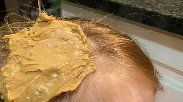 תנסו את זה בבית? חמאת הבוטנים על שיער הילדה תנסו את זה בבית? חמאת הבוטנים על שיער הילדה