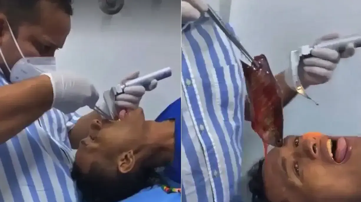 מוציאים דג מפה של דייג מוציאים דג מפה של דייג