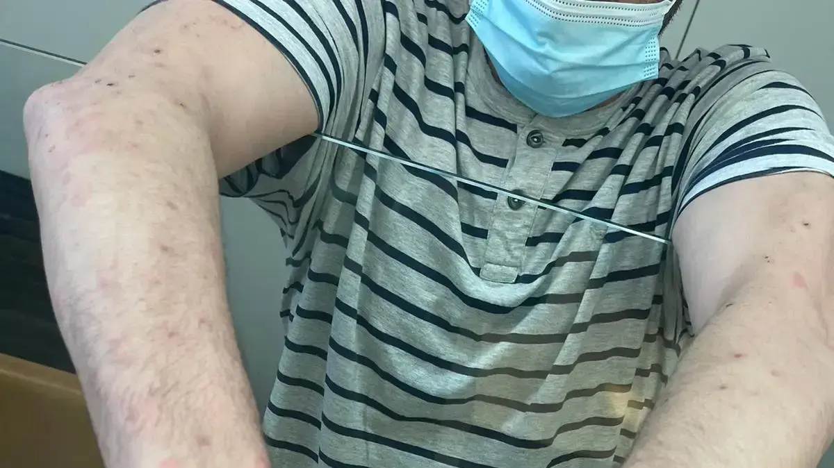 מכת פשפשים בבית המעצר קישון, ג'למה מכת פשפשים בבית המעצר קישון, ג'למה