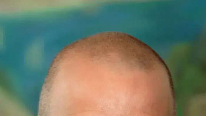 יובל דיסקין יובל דיסקין