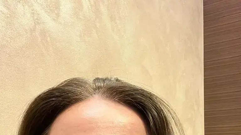 אסנת, התל אביבית שחטפה אגרוף לפנים בברלין וטוענת כי על המעשה רקע אנטישמי 
