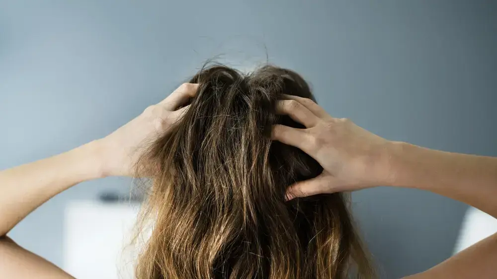 אחת התופעות המרגיזות. אישה מגרדת בראשה אחת התופעות המרגיזות. אישה מגרדת בראשה