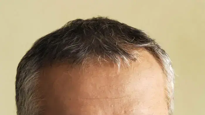 אמנון לוי אמנון לוי