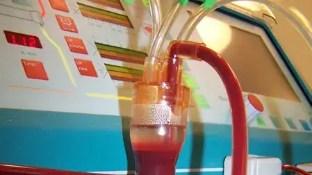אילוסטרציה אילוסטרציה