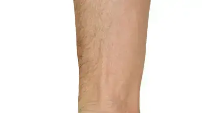 אילוסטרציה אילוסטרציה