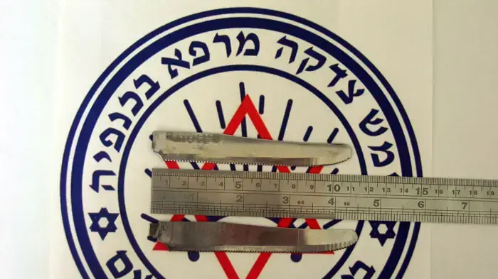 שני סכיני מטבח בקיבתו של חולה אשר הגיע לבית החולים "בקור חולים" שני סכיני מטבח בקיבתו של חולה אשר הגיע לבית החולים "בקור חולים"