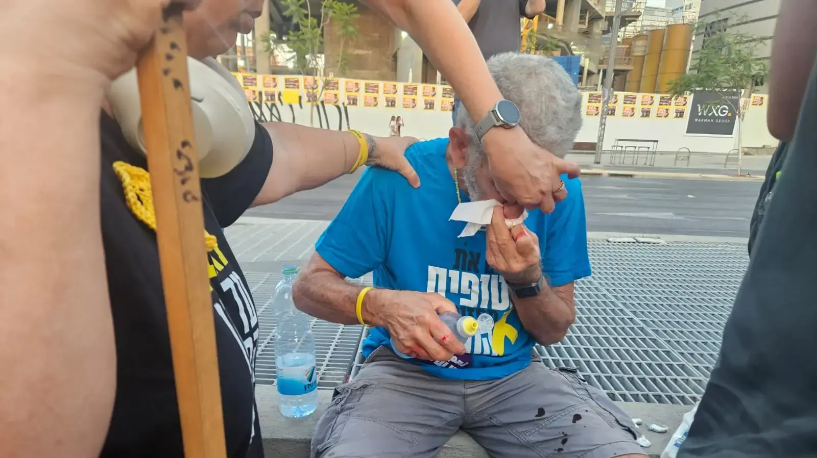 מפגין בן 74 שהותקף בפניו בידי רוכב אופנוע בהפגנה בשער בגין, תל אביב, 21 ביולי 2025 מפגין בן 74 שהותקף בפניו בידי רוכב אופנוע בהפגנה בשער בגין, תל אביב, 21 ביולי 2025