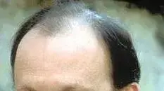 הבמאי ערן ריקליס הבמאי ערן ריקליס