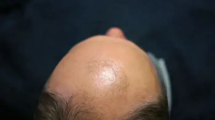 אילוסטרציה אילוסטרציה