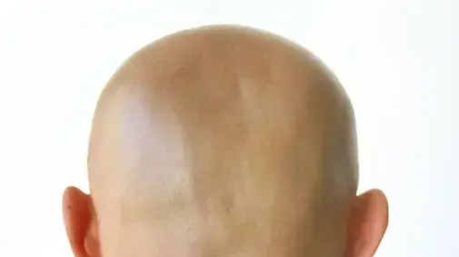 אילוסטרציה אילוסטרציה