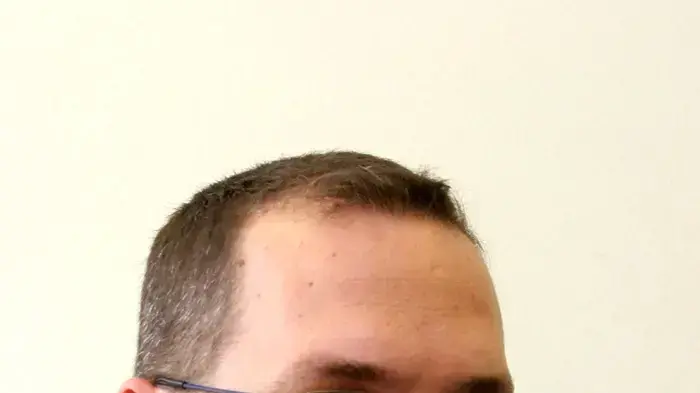 אודי הירש אודי הירש
