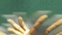 אילוסטרציה ידיים פרקינסון אילוסטרציה ידיים פרקינסון