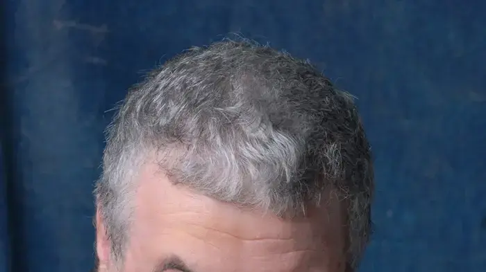 אמנון דנקנר אמנון דנקנר