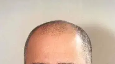 יואב ניסן כהן מנכל משותף טאואר סמיקונדקטור יואב ניסן כהן מנכל משותף טאואר סמיקונדקטור