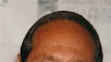 פול אנקה פול אנקה