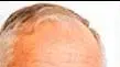 מאיר ניצן ראש עיריית ראשון לציון (מתוך אתר העירייה) מאיר ניצן ראש עיריית ראשון לציון (מתוך אתר העירייה)