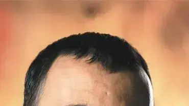 שמעון בוסקילה שמעון בוסקילה